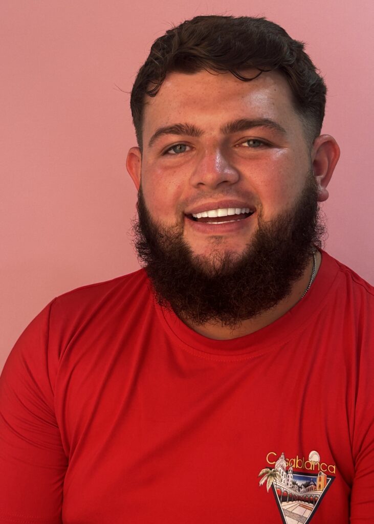 Over The Moon Smile Turkey Teeth Hollywood Smile White Teeth