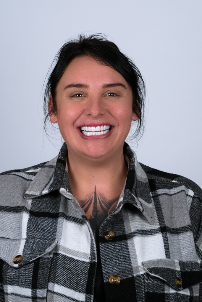 Over The Moon Smile Turkey Teeth Hollywood Smile White Teeth